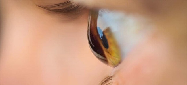 Los problemas más frecuentes de la retina - Eurocanarias Oftalmológica