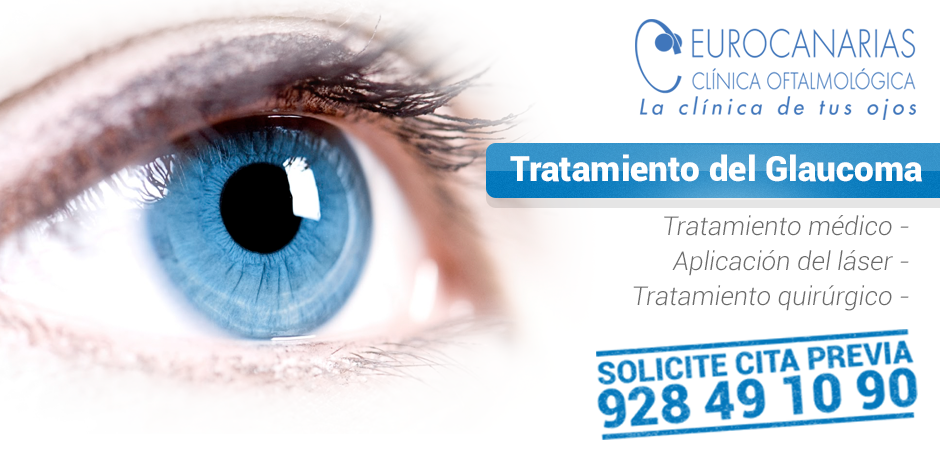 La Clínica Eurocanarias Oftalmológica ofrece en marzo revisiones gratuitas para detectar precozmente el glaucoma
